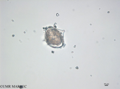 phyto/Bizerte/bizerte_bay/RISCO April 2014/Protoperidinium divergens (141212_001_ovl-6)(copy)_thumb.jpg